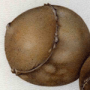 Three galls (Andricus quercustozae)